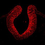IF of 5ss chick embryo midbrain level cross-section stained with DSHB antibody P2C62C4 against ITGA6 (red). Image credit: PMID 26317350, Fig. 5A
